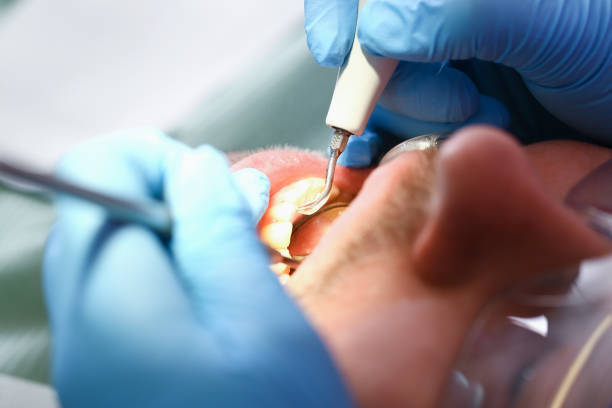 Best Emergency Tooth Extraction in Holiday Heights, NJ